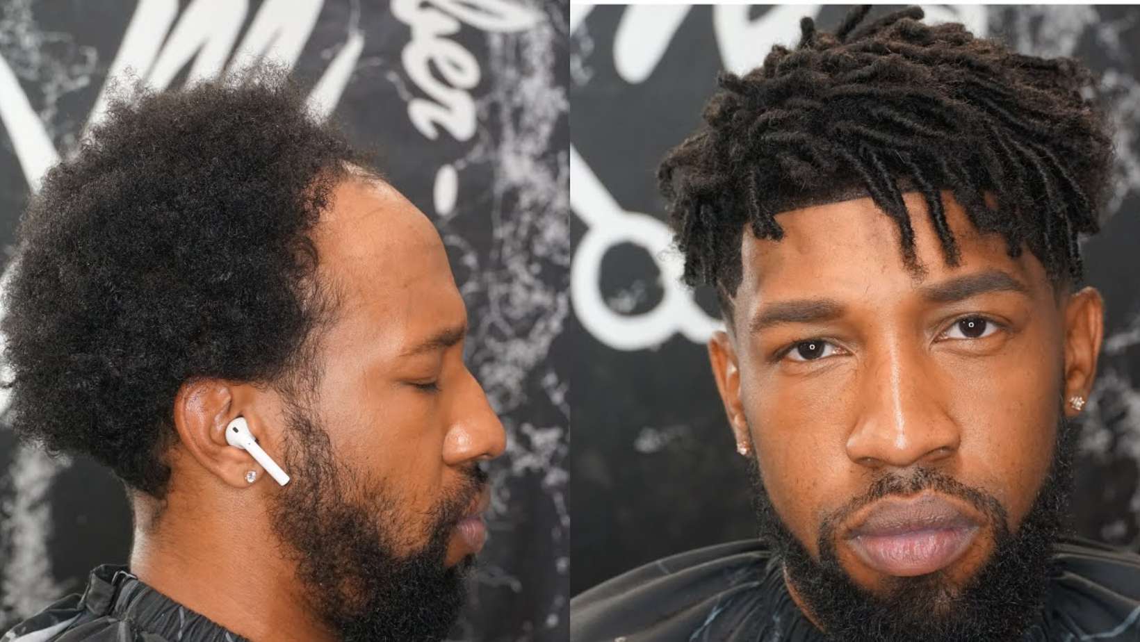 Hair Units for Men: A Complete Guide
